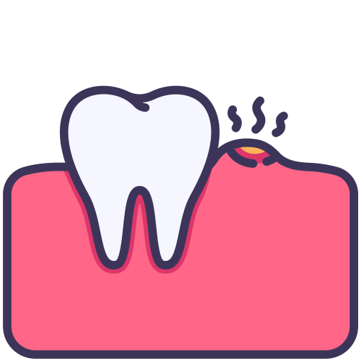 Agresif Periodontitis