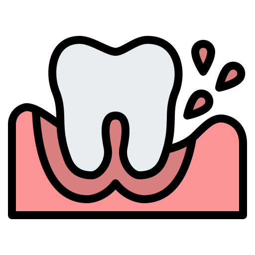 Chronic Periodontitis